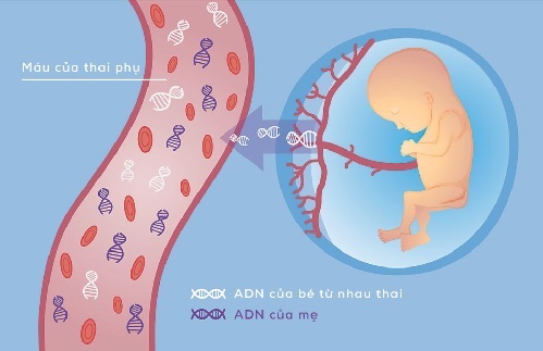 Sàng Lọc Dị Tật Bẩm Sinh Không Xâm Lấn